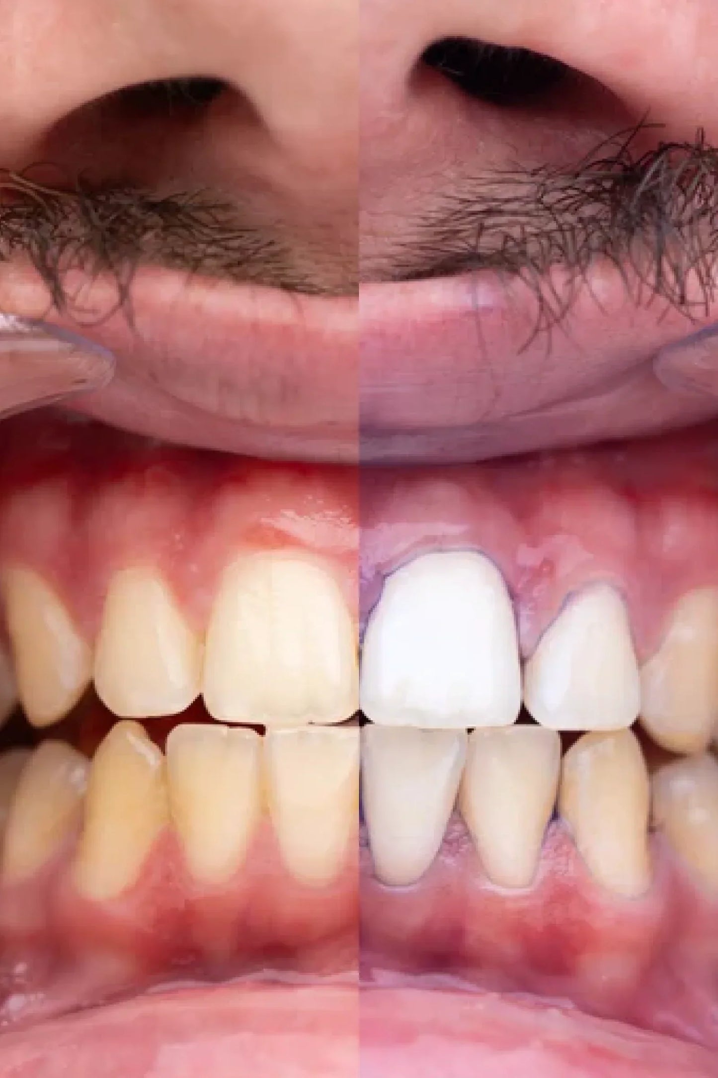 Smile Purple V34